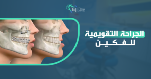 الجراحة التقويمية للفكين