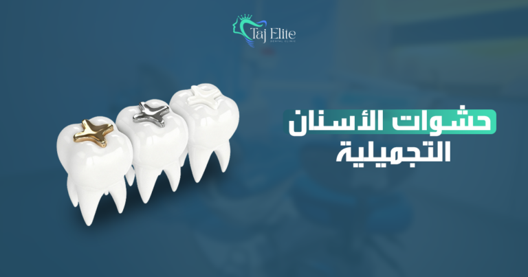 حشوات الأسنان التجميلية
