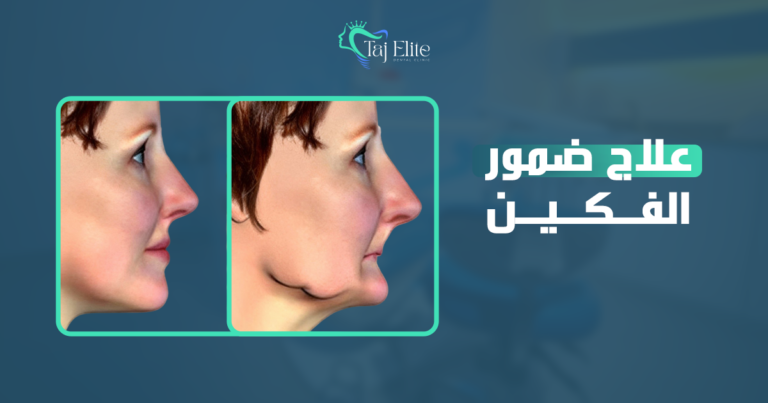علاج ضمور الفكين